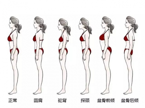 驼背,圆肩,假翘臀……5个最毁气质的体态,手把手教你怎么纠正!