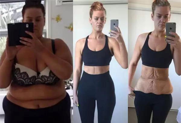 肥婆怒减70斤 成了全球社交媒体红人 ，锻炼方法曝光
