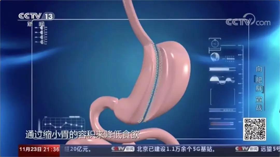 从央视肥胖记实片，看中国人的「减肥难」